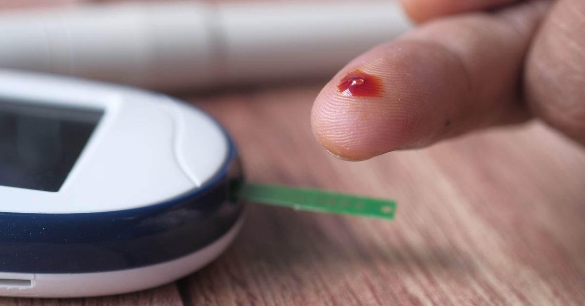 Pet Blood Sugar Monitoring