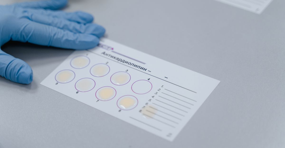 Pet Allergy Test Results